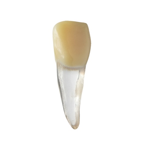 BIOMED 3D Tooth - Ząb treningowy - 9 skalcyfikowany