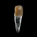 BIOMED 3D Tooth - Ząb treningowy - 9 skalcyfikowany