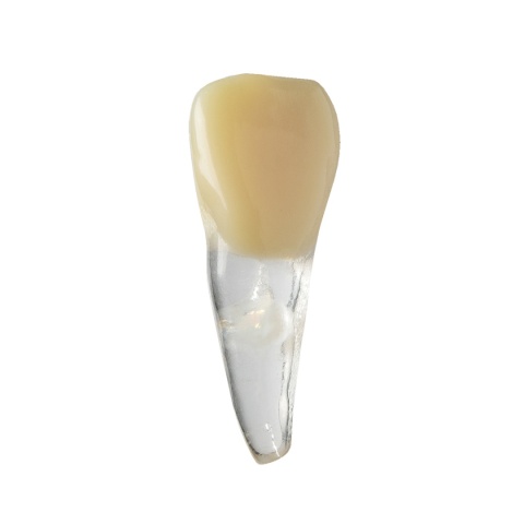 BIOMED 3D Tooth - Ząb treningowy - 9 z resorpcją