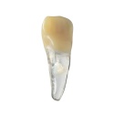 BIOMED 3D Tooth - Ząb treningowy - 9 z resorpcją