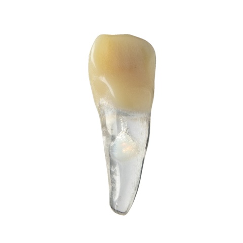 BIOMED 3D Tooth - Ząb treningowy - 9 z resorpcją