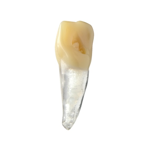 BIOMED 3D Tooth - Ząb treningowy - Centralny siekacz 1,4 mm otwarty wierzchołek